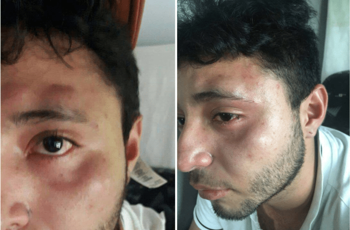 Jorge Cosayoga Ruiz golpeado por Animalover