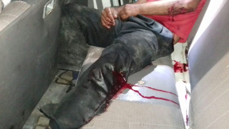 Por venganza, hieren de bala a hombre dos veces en Chetumal