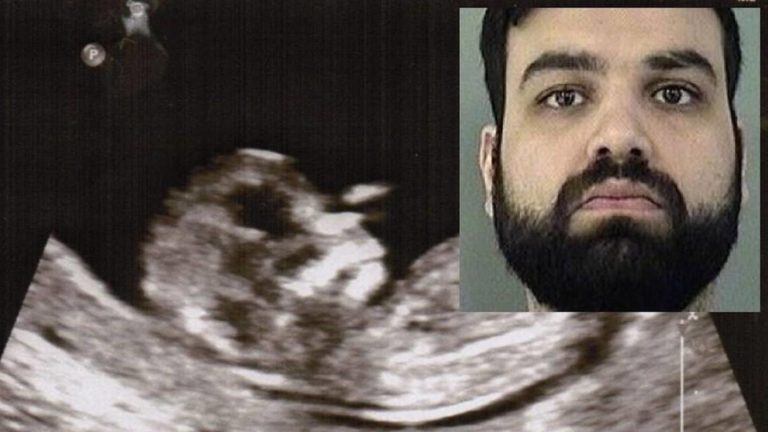 Sentencian a Doctor que a escondidas suministró una píldora abortiva a su novia