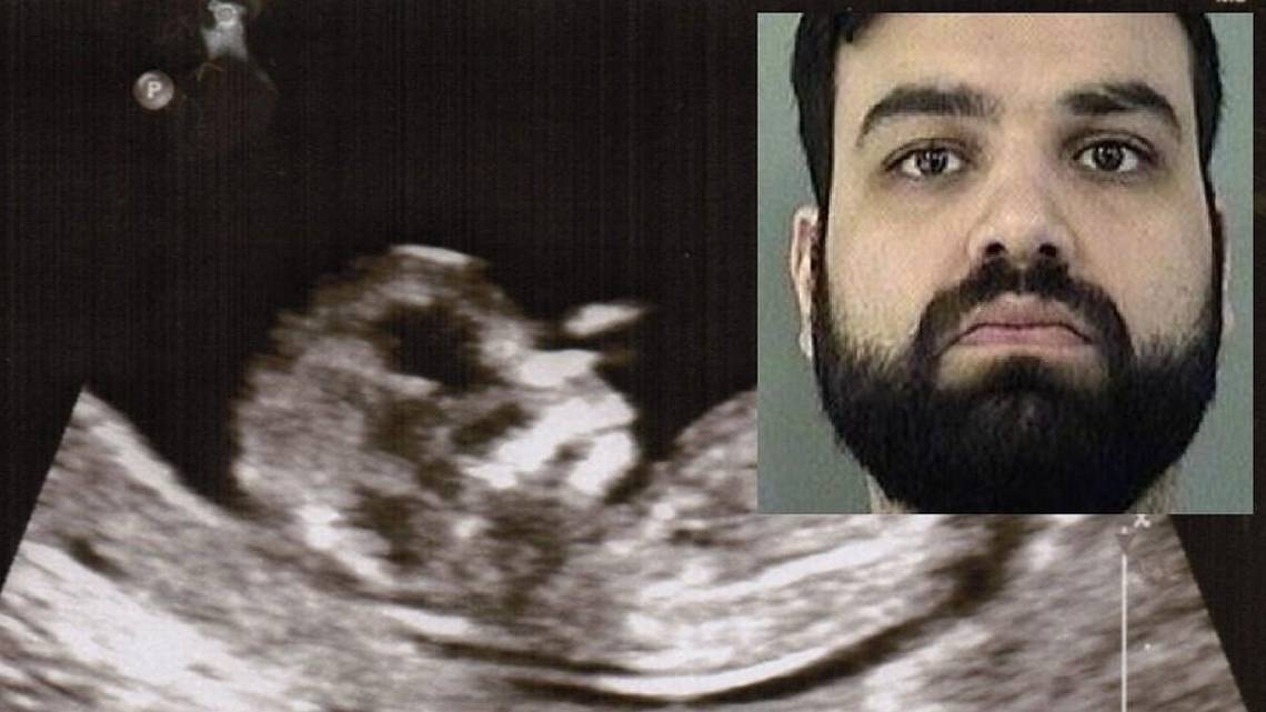 Sentencian a Doctor que a escondidas suministró una píldora abortiva a su novia