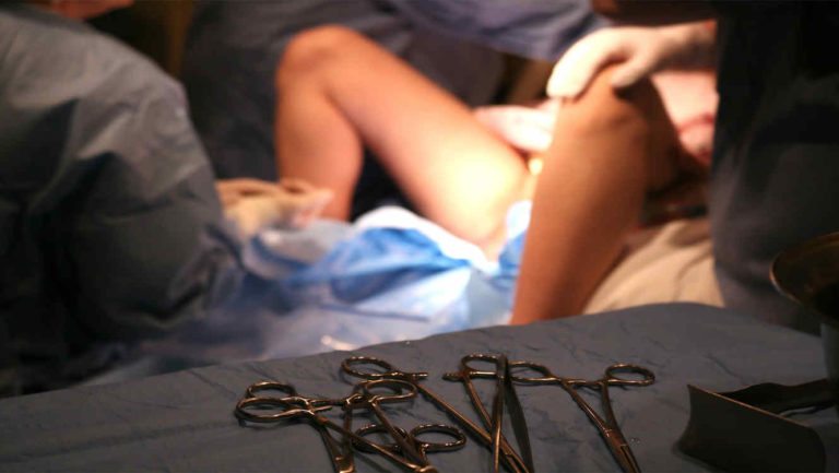 Bebé fue decapitado durante el parto por error de la doctora