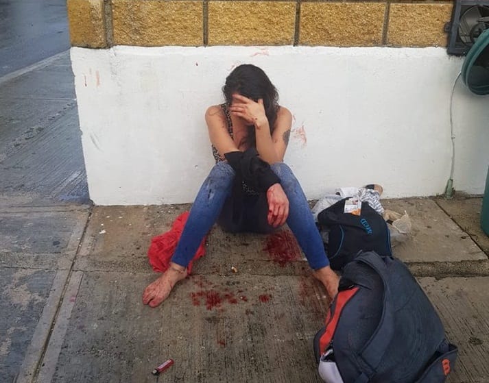 Joven cacha a su novio con otra y se corta el brazo