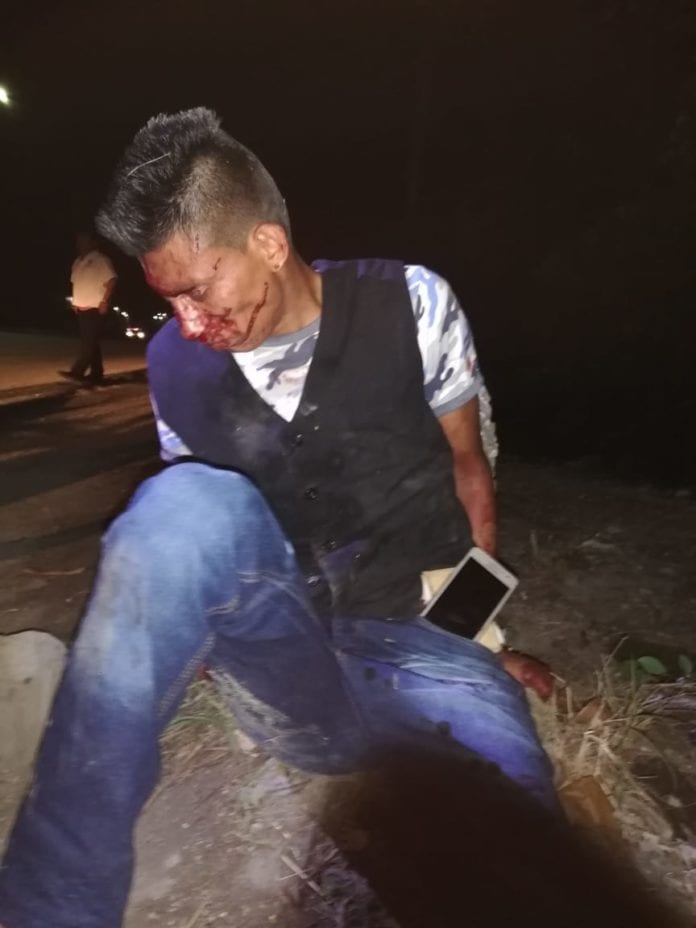 Por no usar el puente, lo atropellan y dejan tendido en Puerto Aventuras