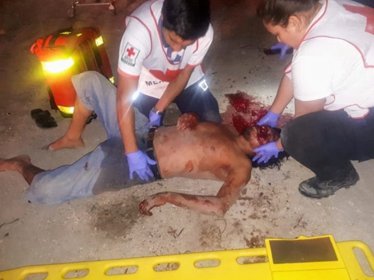 Se fractura la cabeza tras caer de un primer piso en Chetumal