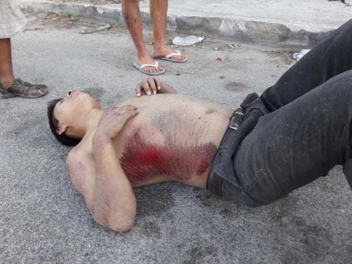 Le pasan las llantas por encima y terminan con su vida