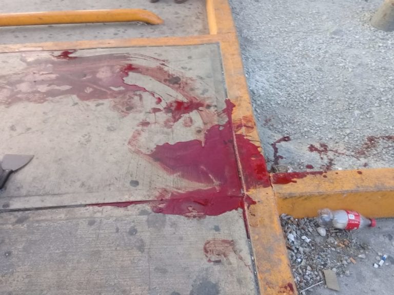 Disparan a pareja cancunense en las rodillas