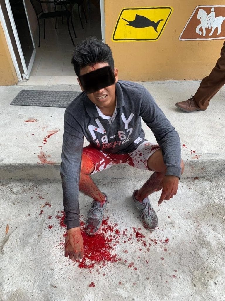 Balean a ambulante en playa del Puerto Morelos