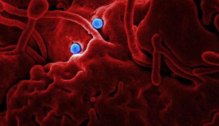 Hombre se suicida por pensar que tenía coronavirus