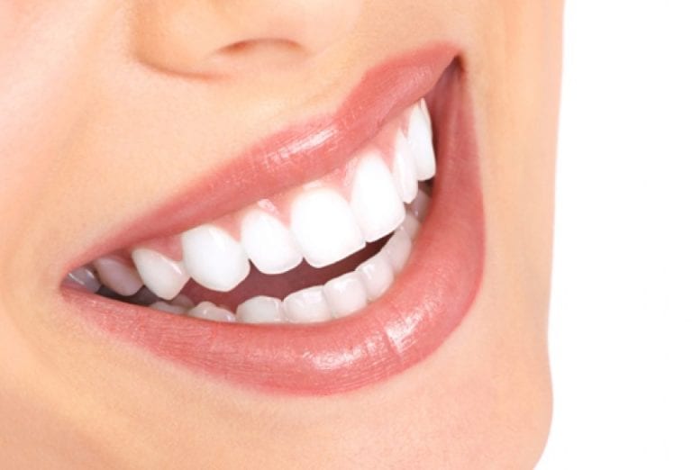 Una extraña enfermedad provoca que crezcan pelos en la encías de mujeres