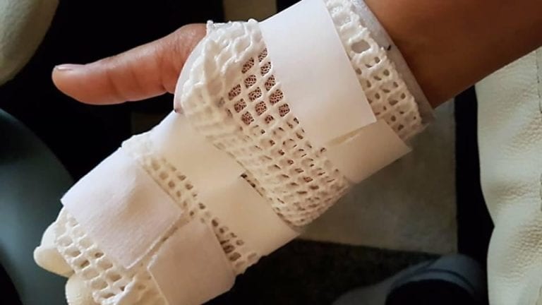 Golpeó hasta cansarse y le amputó los dedos a una mujer en Playa del Carmen