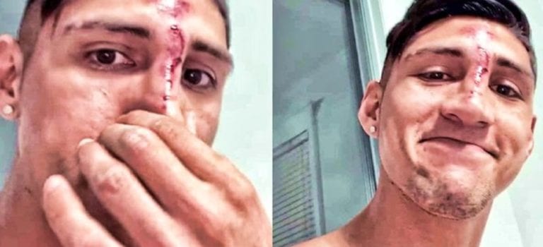 Video: Alan Pulido se rompe toda su “jefesita”  tras accidente casero