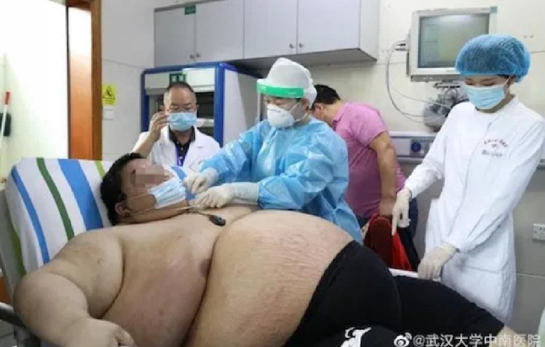 Subió más de 100 kilos por el encierro debido al Covid-19