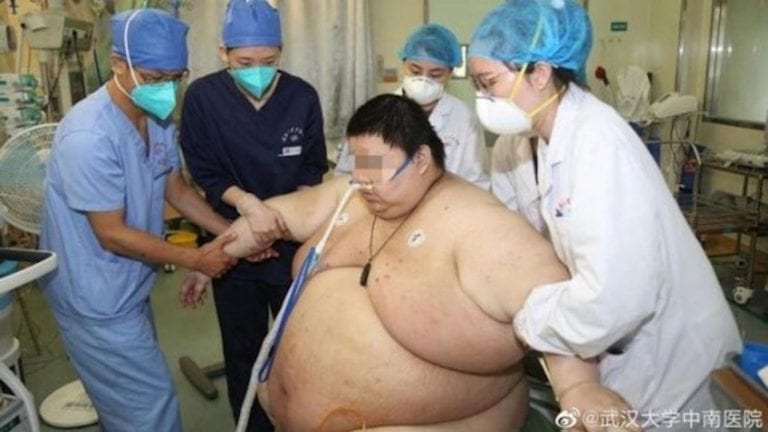 Hombre subió más de 100 kilos en China por el encierro por Covid-19