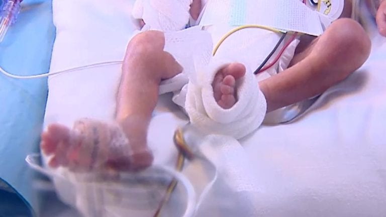 Grave, bebé que sobrevivió al asesinato de su madre; lo alcanzó el cuchillo