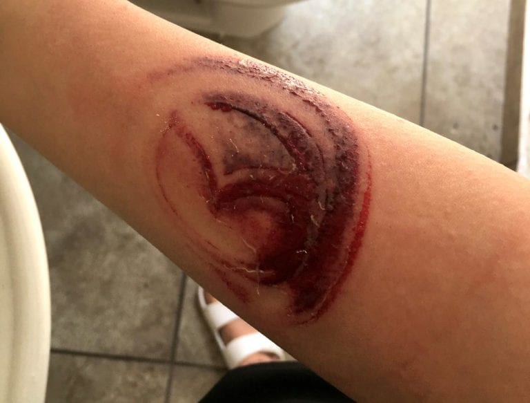 Choca, le queda marcado el logo de Mazda y pide dinero a la empresa