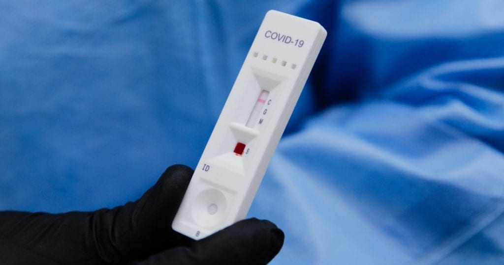 covid-19-Test