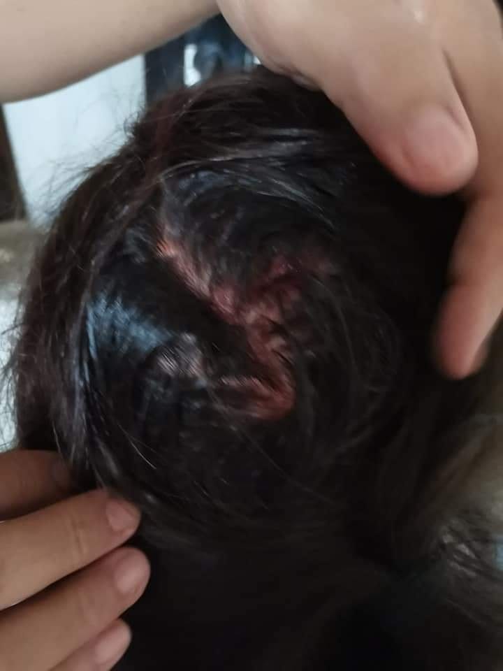 Al escuchar los gritos los vecinos la auxiliaron, pues con trabajos cruzó hacia el patio de la casa del vecino, donde la auxiliaron y llamaron a las autoridades.