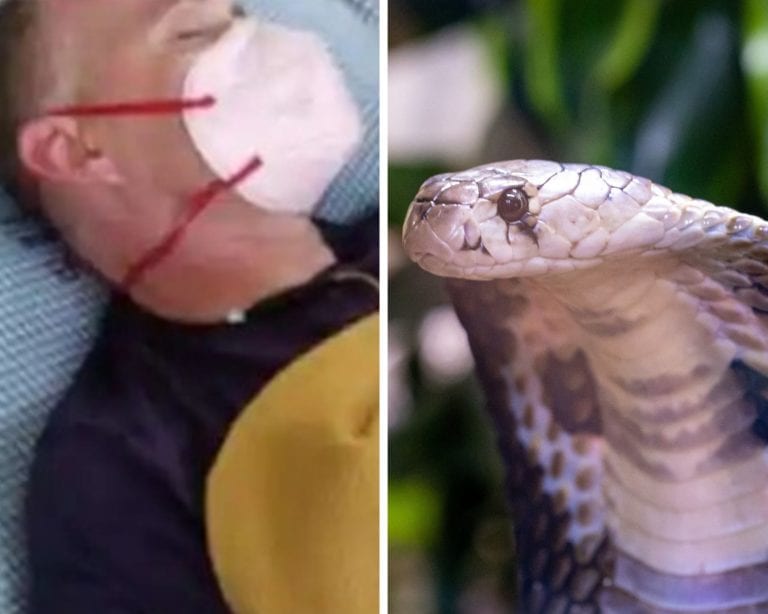 Hombre que se recuperó de la malaria, el dengue y el covid-19, es mordido por una serpiente venenosa