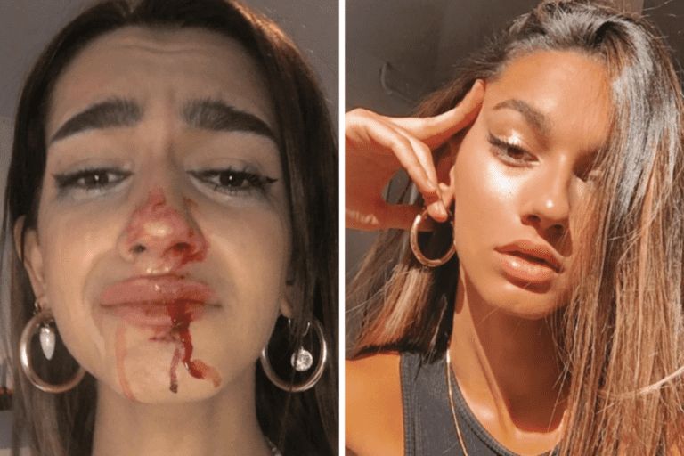 Dan tremenda golpiza a influencer por ser ‘trans’: ‘No quiero morir mañana’