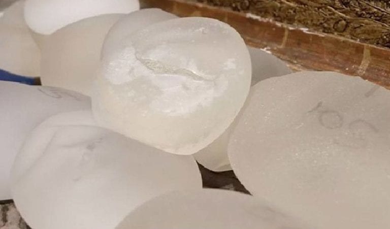 Detienen a traficantes de drogas, usaban implantes mamarios como medio de transporte