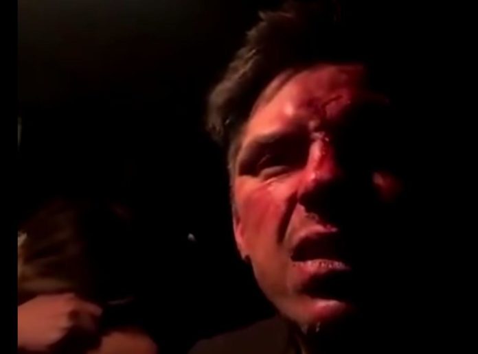 Un hijo de Lupita D'Alessio acusa a un primo de EPN de haberlo golpeado y amenazado de muerte; mira las imágenes de lo ocurrido