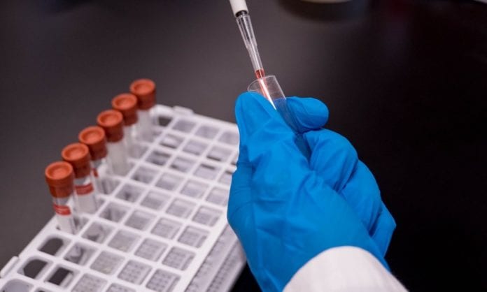 Vacunas para Covid-19