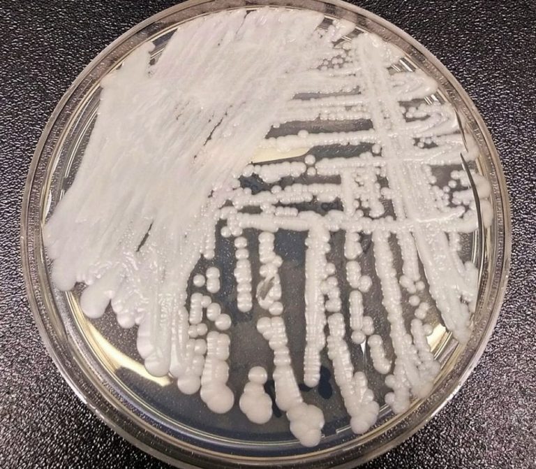 Reportan en Brasil posible caso de infección por ‘Candida auris’, un hongo peligroso