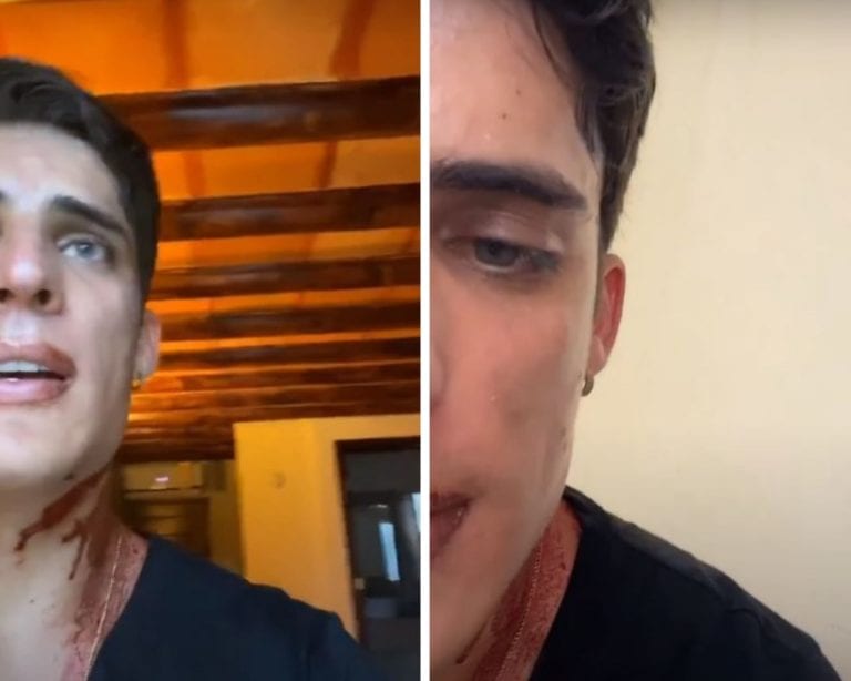 Exnovio de la mamá de Neymar, Tiago Ramos, revela que lo apuñalaron en Cancún