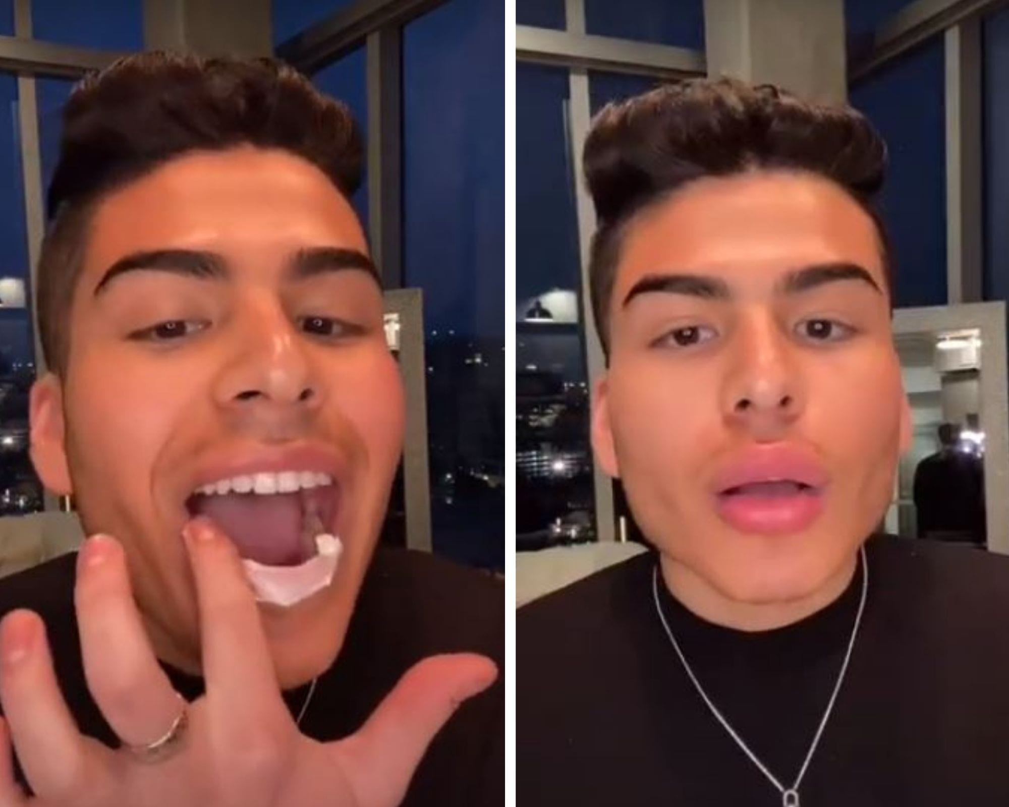 Video: Surge nueva tendencia en TikTok de ponerse 'crema de erección' en los labios para hacerlos crecer