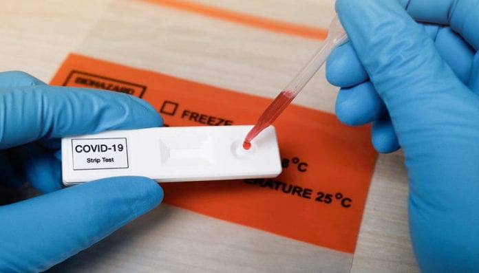 Rapid covid-19 strip Test
