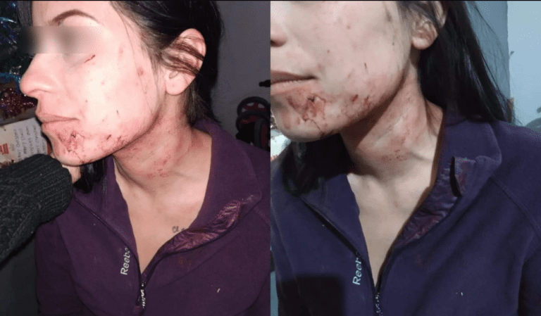 Mujer denuncia a escolta de gobernador de Torreón por golpes y amenazas