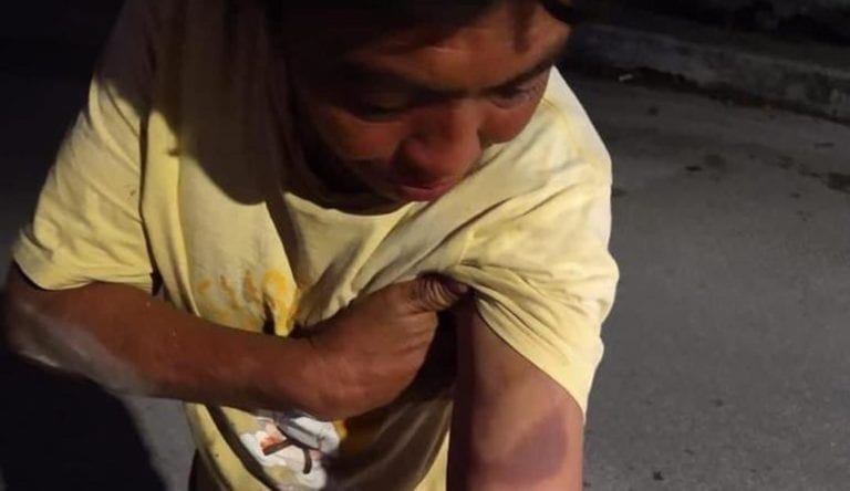 Unos priistas de Campeche han sido exhibidos en redes tras agredir a una persona con discapacidad en un evento de su candidato a la gubernatura