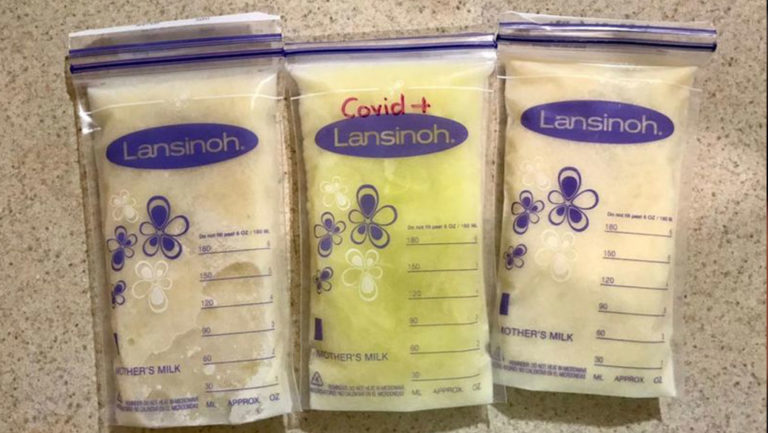 Color de la leche materna de una mujer cambió a verde luego de contraer Covid-19