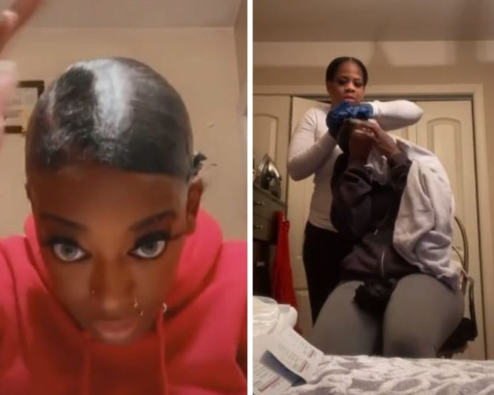 Mujer usa pegamento en vez de laca para su cabello, la hospitalizan por tener un mes sin poder quitarlo