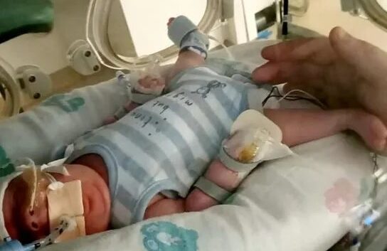 Bebé prematuro de 765 gramos venció al Covid y luego una infección intestinal