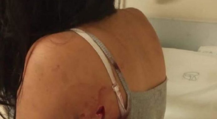 Una mujer ha sido agredida desde hace 10 años por su ex esposo; esta vez el hombre la atacó a machetazos