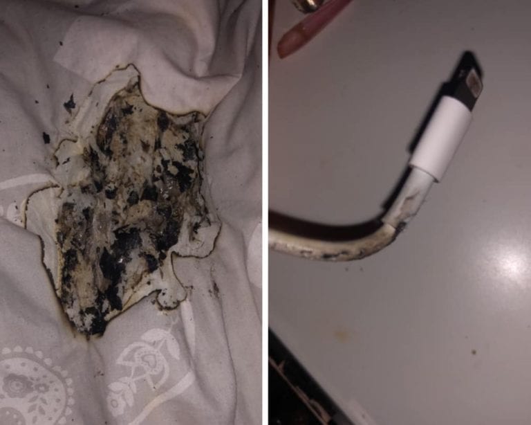 Joven sufre fuertes quemaduras en la cara luego de que el cargador de su iPhone explotara