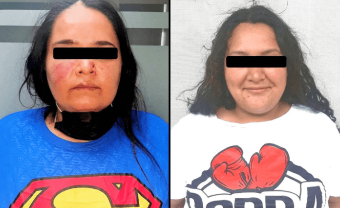 Mujeres se agarraron a golpes por deuda de 60 pesos, una de ellas perdió un diente.