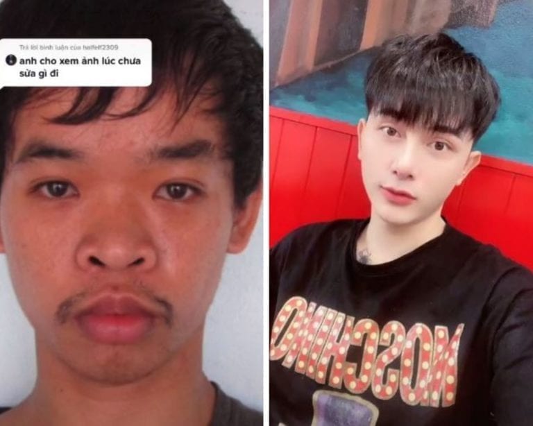 Video: No le daban trabajo por “feo”, se opera el rostro y luce irreconocible