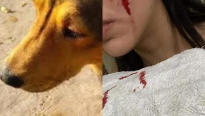 'Rodolfo Corazón' habría mordido a Adriana