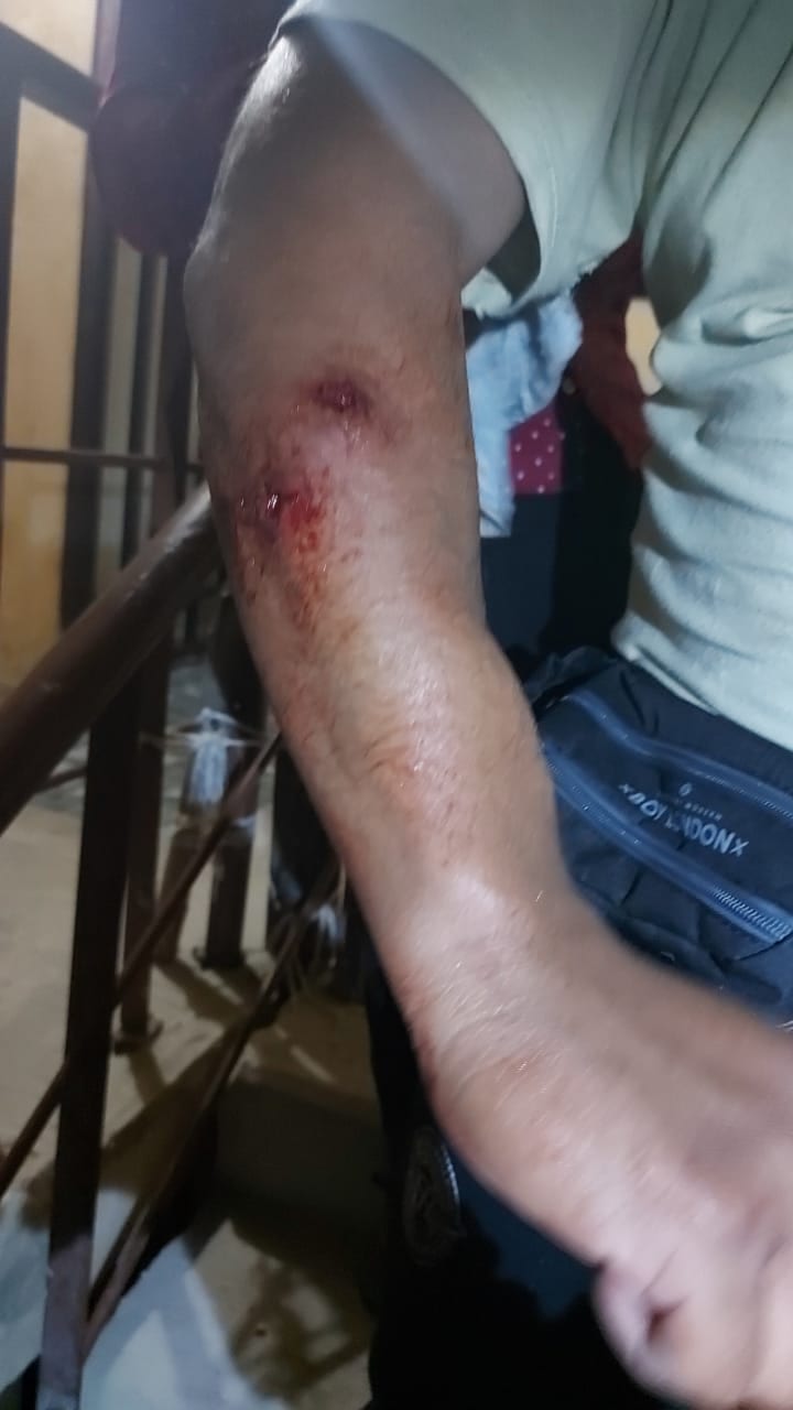 Impide agresión a una mujer y le disparan en Cancún