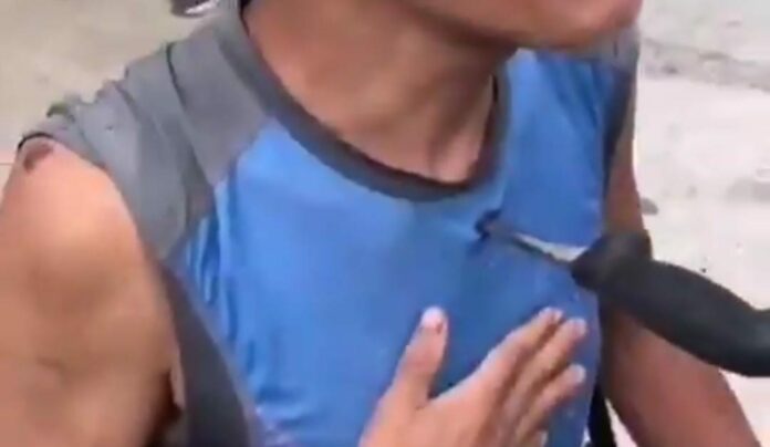 Un sujeto fue apuñalado en una riña familiar; a causa de ello un cuchillo se le quedó incrustado en el pecho; vivió para contarlo