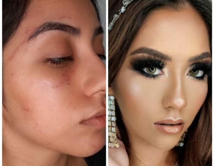 En recuperación Miss Turismo Yucatán: mujeres intentan desfigurar su rostro