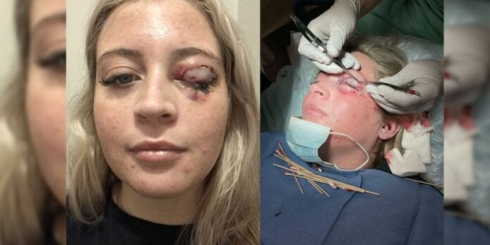 Kelsey Salmon, de 23 años de edad