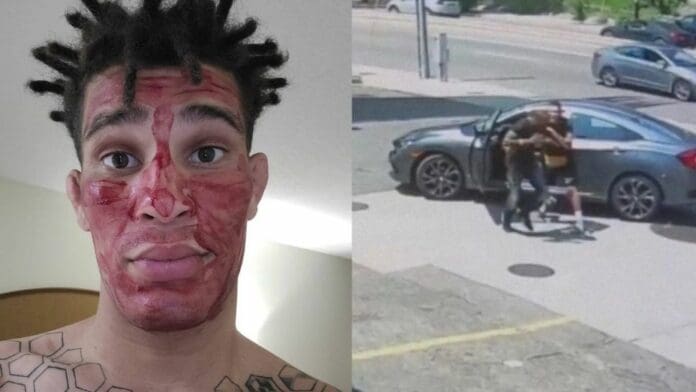 Ladrón intenta robarle a un luchador y recibe la golpiza de su vida