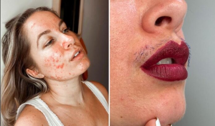 Influencer se deja el bigote para combatir estándares de belleza