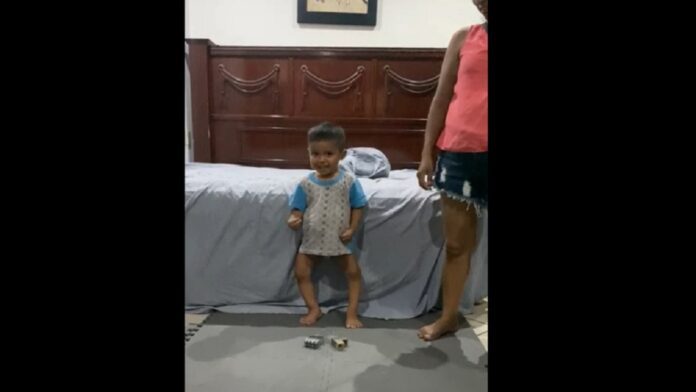 Piden apoyo para Miguelito, niño playense con la enfermedad de Blount