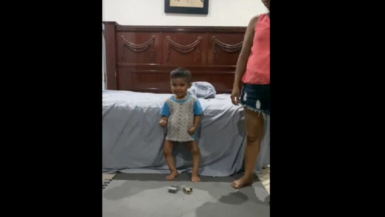 Piden apoyo para Miguelito, niño playense con la enfermedad de Blount