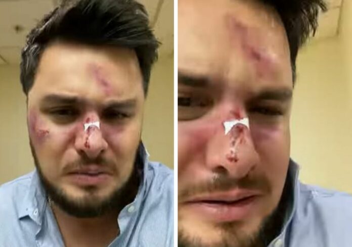 VIDEO: Paul Stanley y el 'Burro' Van Rakin se dan 'golpiza' y se vuelven virales