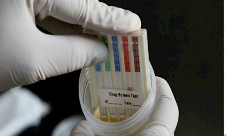 Un hombre da positivo en todas las pruebas del 'Narcotest'